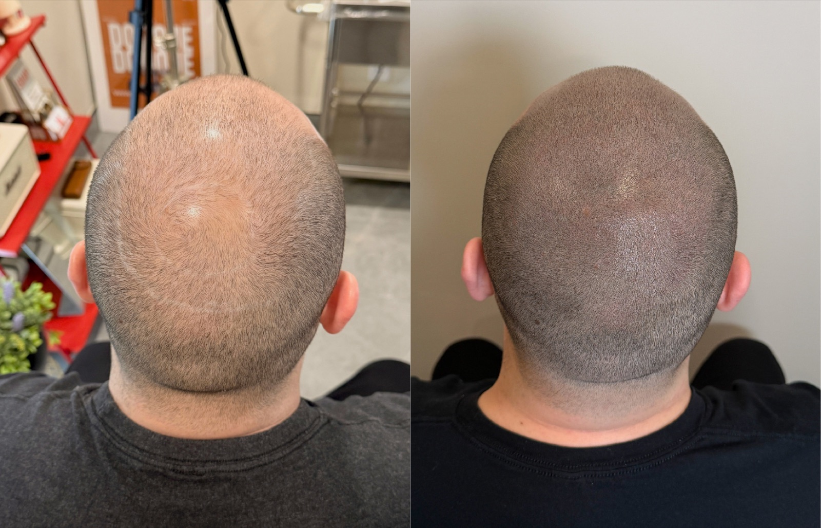 Shaved look SMP portfolio 7